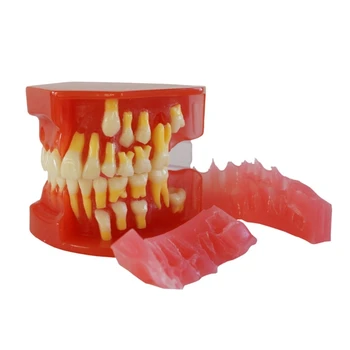 G5AA Модель реставрационных зубов с 28 съемными зубами для клинических исследований